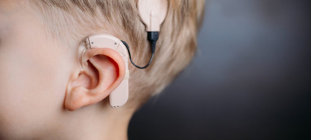 cochlear implant on the boy’s head. hearing aid. copy space